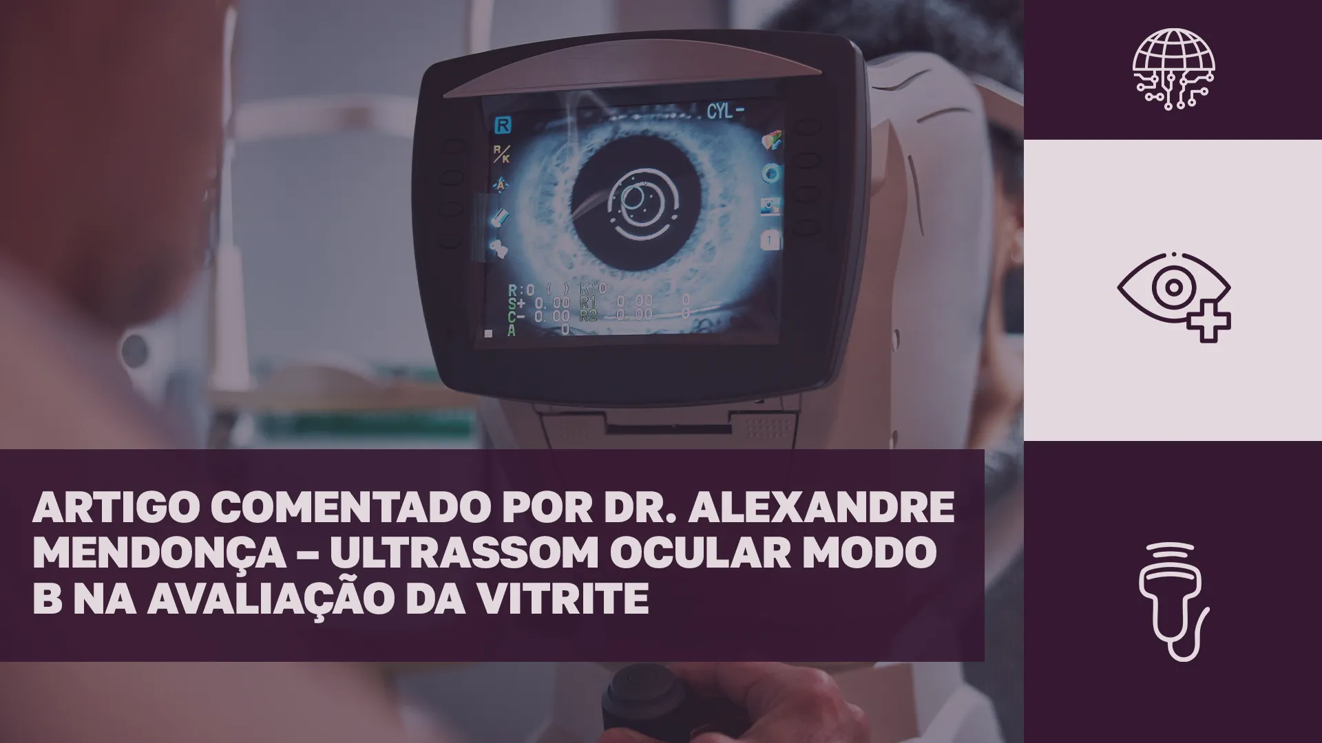 O Ultrassom Pode Ajudar no Diagnóstico da Vitrite? Estudo do Dr. Alexandre Mendonça Traz Novas Perspectivas