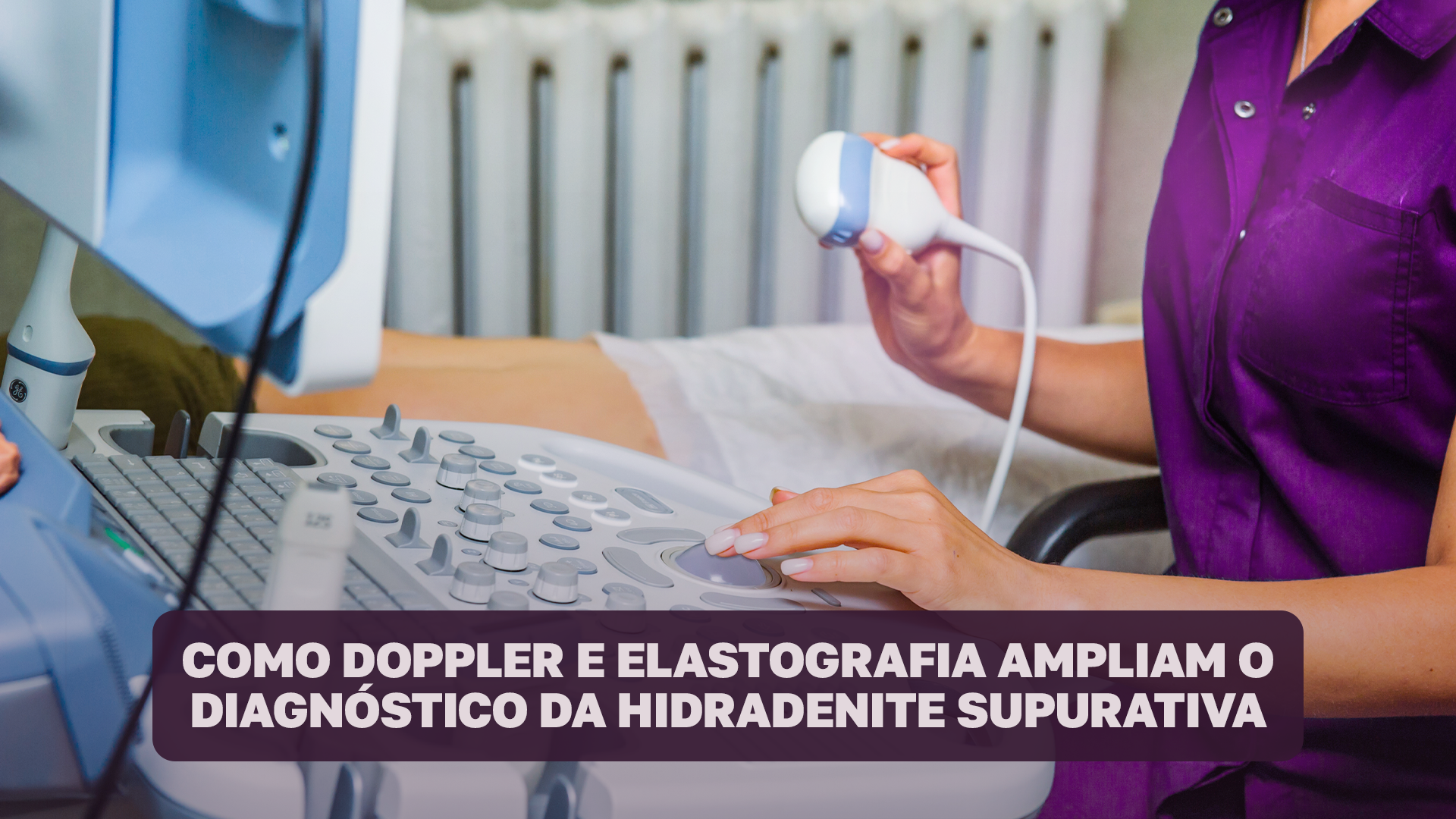 Artigo comentado: Como Doppler e elastografia ampliam o diagnóstico da Hidradenite Supurativa