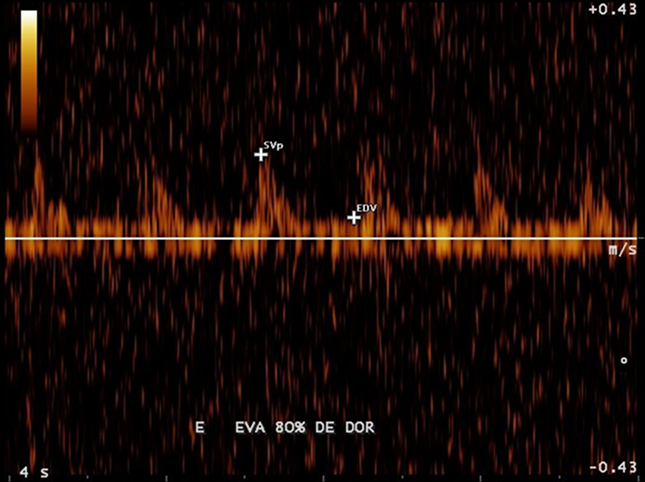 Imagen de ultrasonido