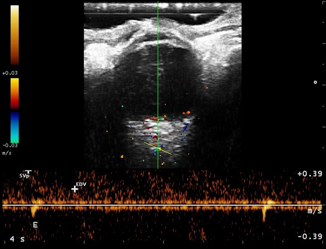 Imagen de ultrasonido